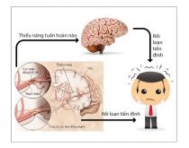 Rối loạn tiền đình