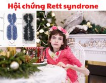 Hội chứng Rett